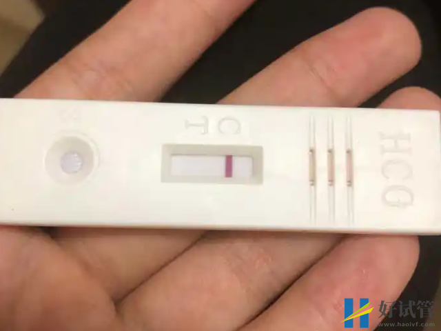 女性高泌乳素血症诊断标准分享,六项激素超过这个值要谨慎(图1) 高泌乳素血症会引起不孕
