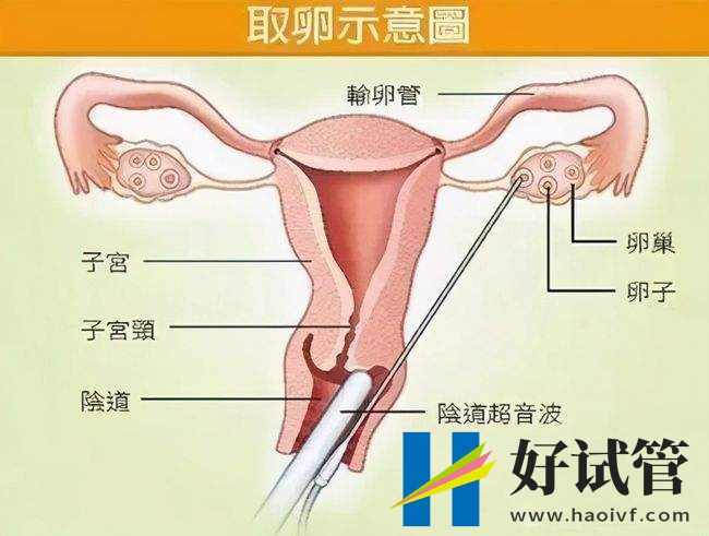试管婴儿移植前吃辅酶q10和维E的功效盘点,能帮助着床别不知(图1) 202201191353068685.jpg